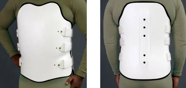 Front and back views of a person wearing a white clamshell back brace