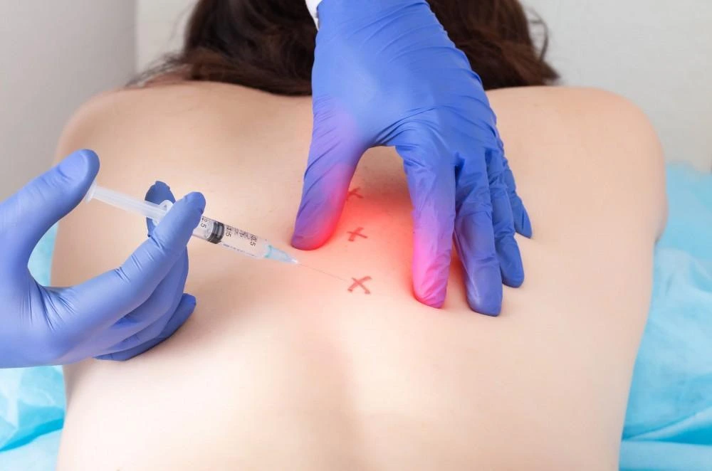 Woman receiving trigger-point injections in the upper back