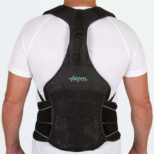 Image demonstrating a patient wearing a prefabricated TLSO back brace