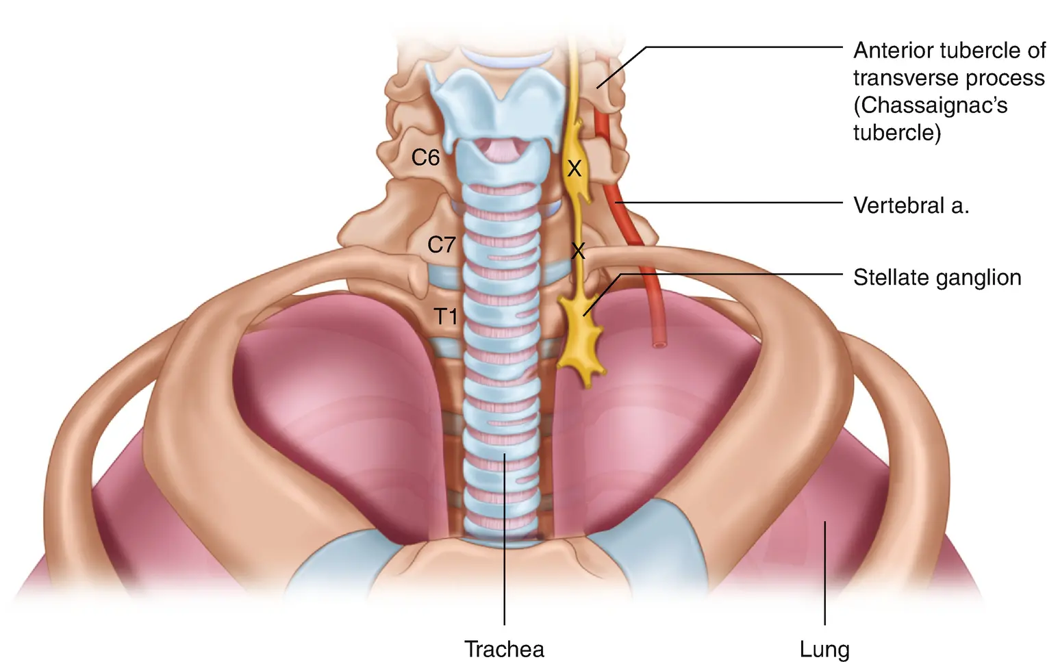 Stellate Ganglion Illustration depicting the location and surrounding anatomy of the stellate ganglion