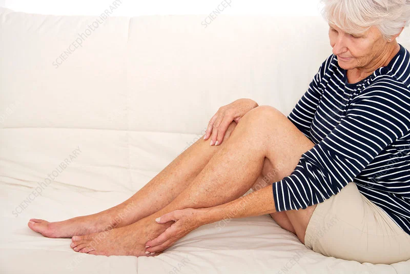Senior woman holding her foot due to diabetic nerve pain